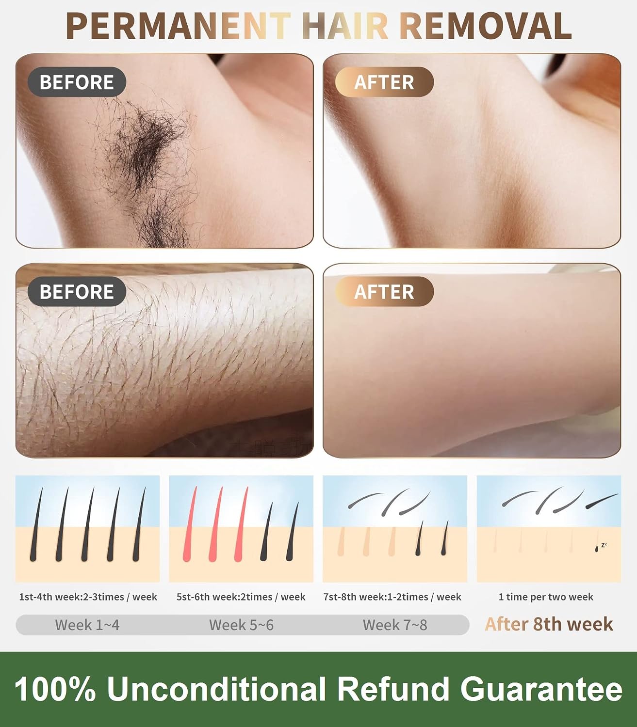 IPL Laser Hair Removal Device for Women and Men - Permanent Painless 90% Hair Reduction in 4 Weeks, Whole Body Use (Armpits, Bikini Line, Face, Legs, Arms, Back) - Corded At-Home