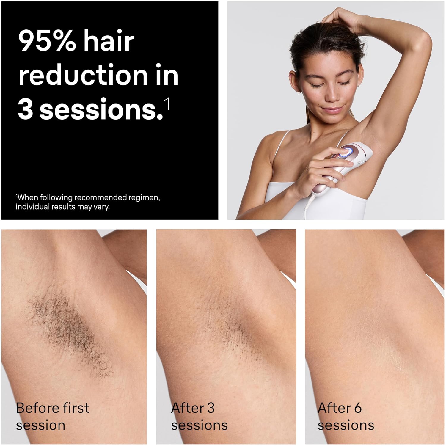 Braun IPL, Silk·Expert Pro 5, IPL Hair Removal for Women and Men, Permanent Laser Hair Reduction At-Home, 1 Head, IPL5100